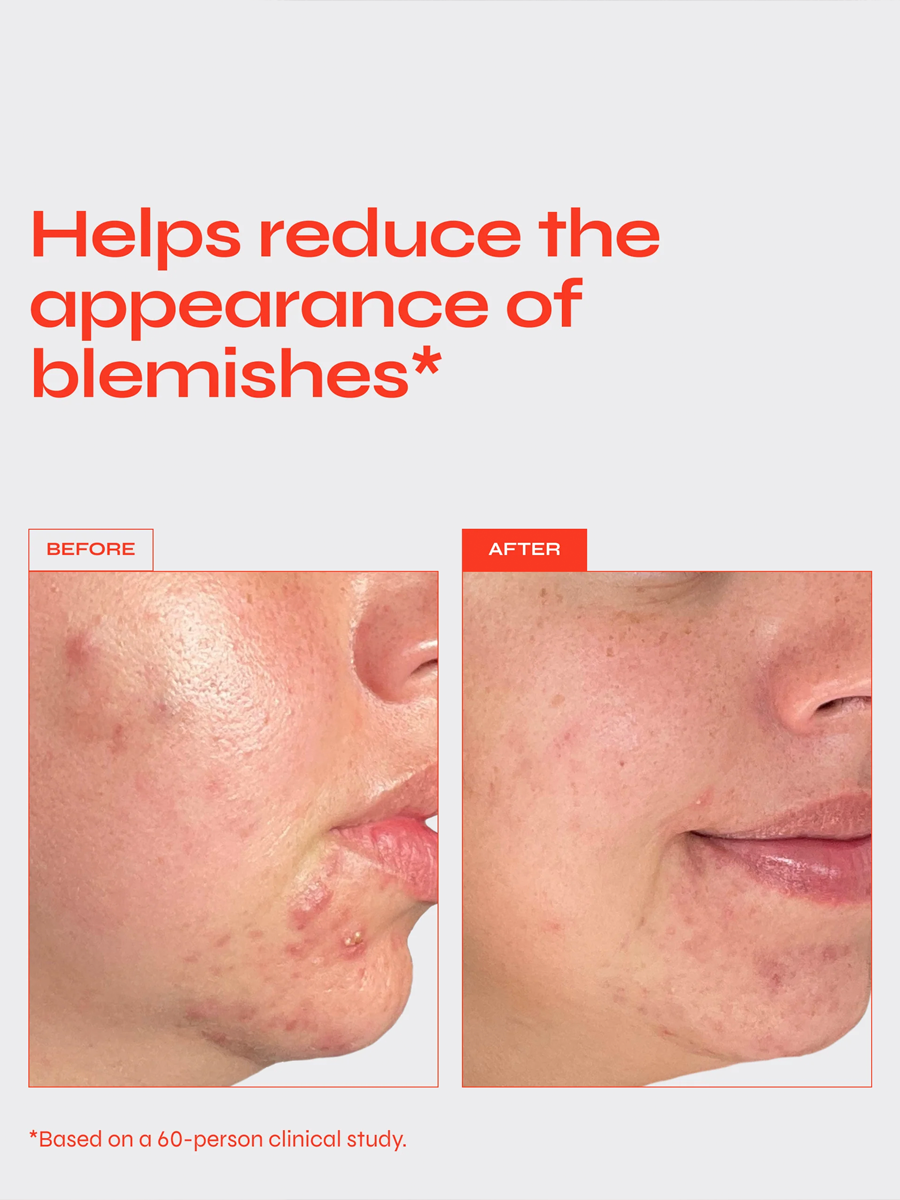 Clear Targeted Blemish Serum