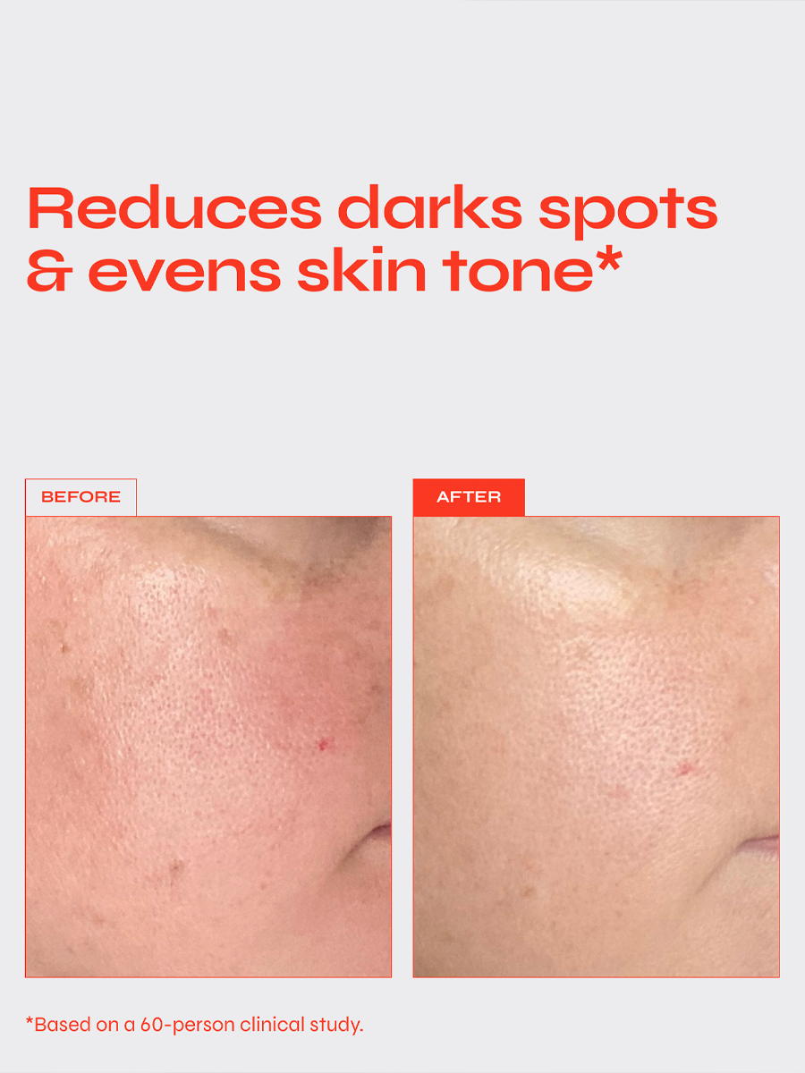 Brighten Serum
