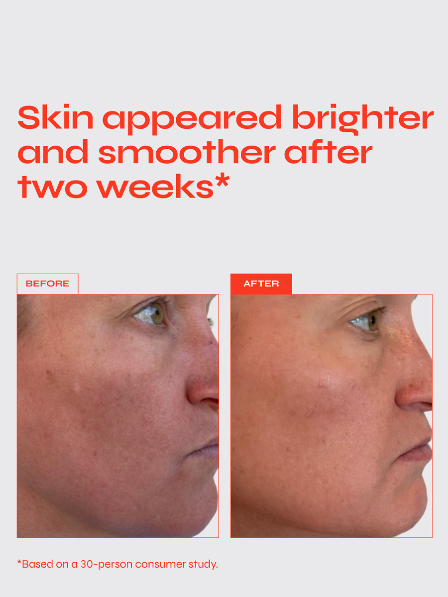 The Buzz Exfoliating Mask