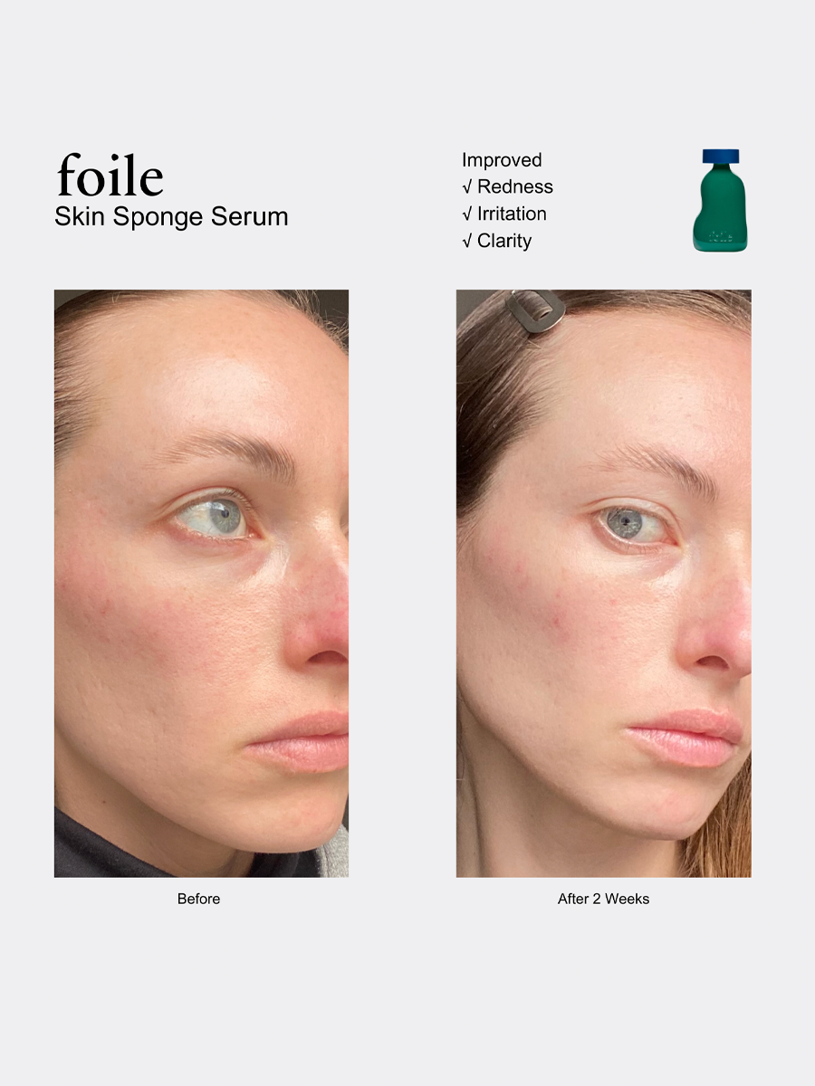 Skin Sponge Serum