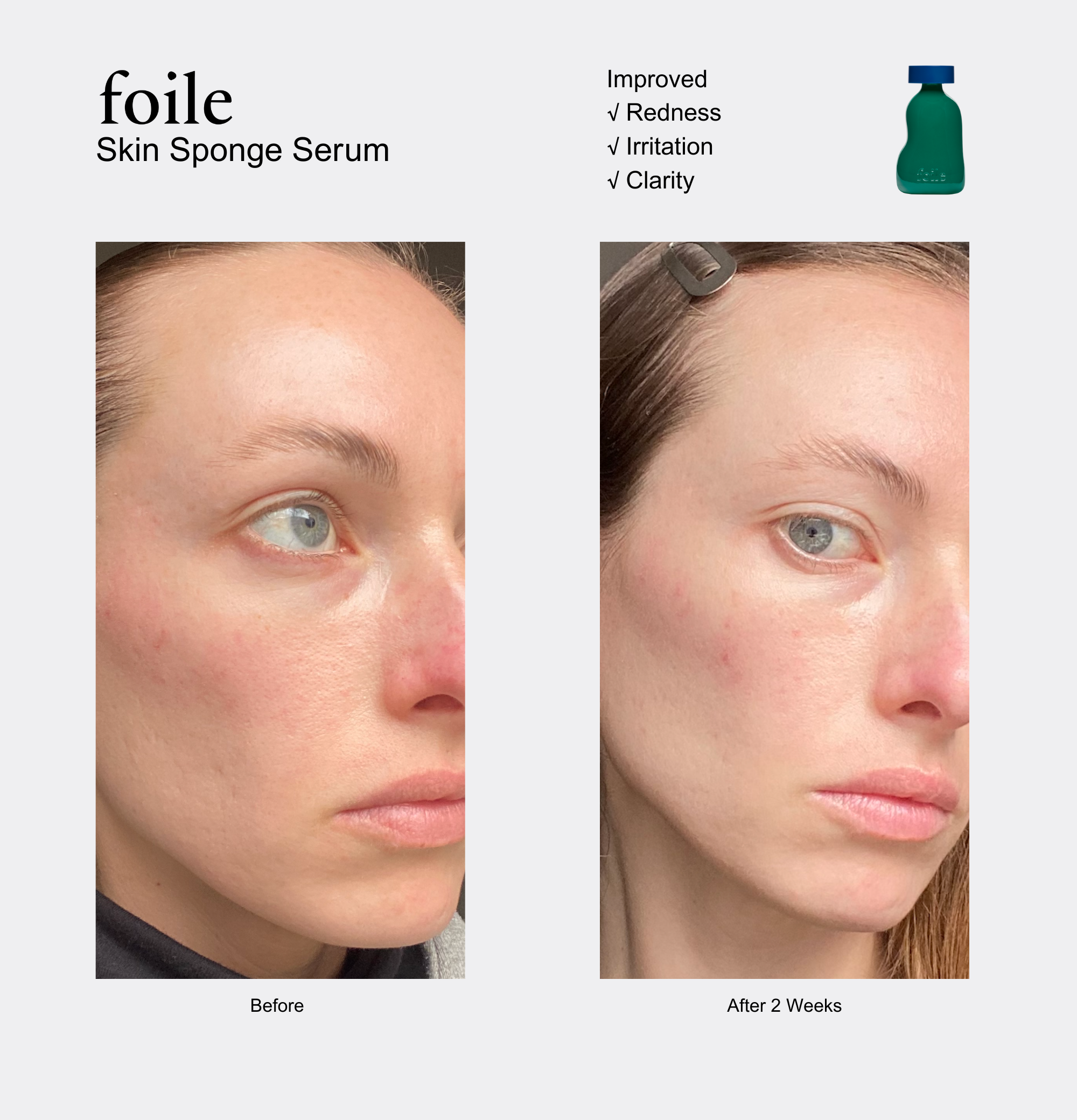 Skin Sponge Serum